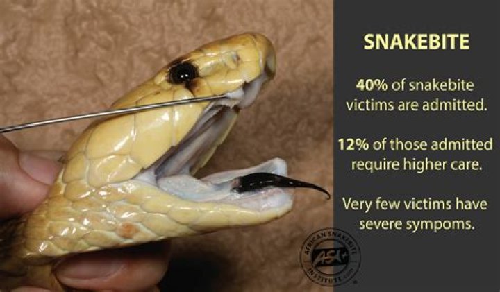 Has anyone survived king cobra bite?