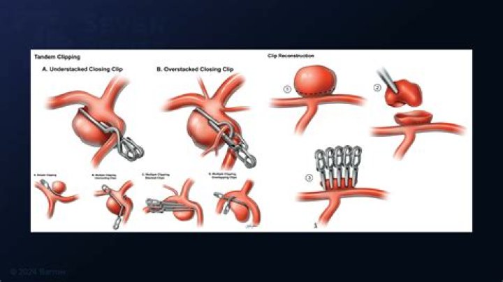 How big is the MCA industry?