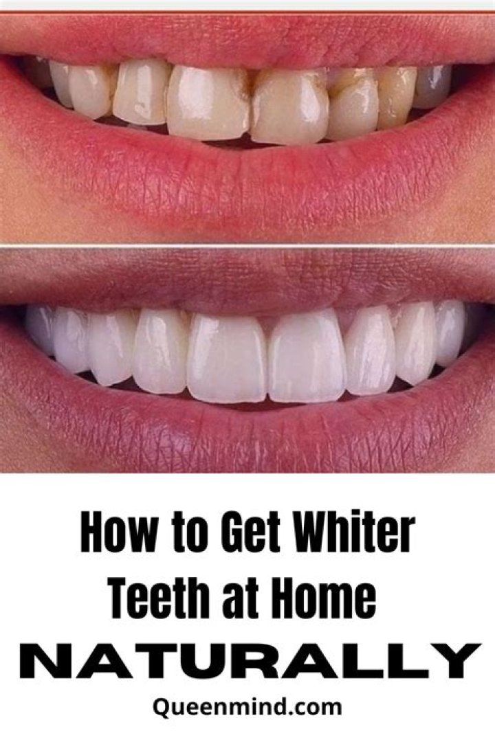 How can I get whiter teeth naturally?