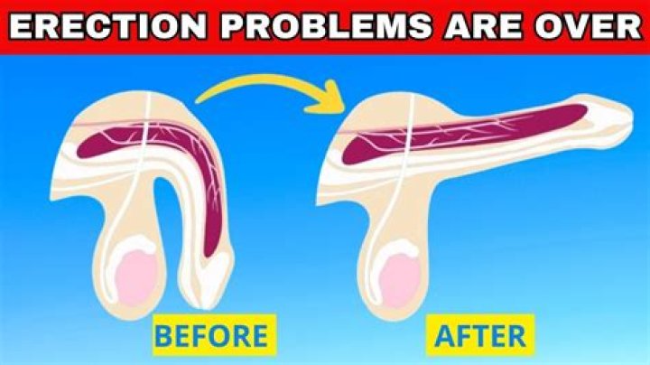 How can I keep an erection at 70?