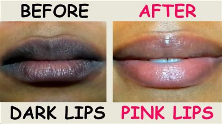 How can I make my black lips pink permanently?