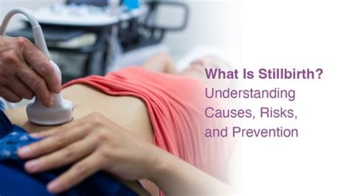 How can I prevent a stillbirth?