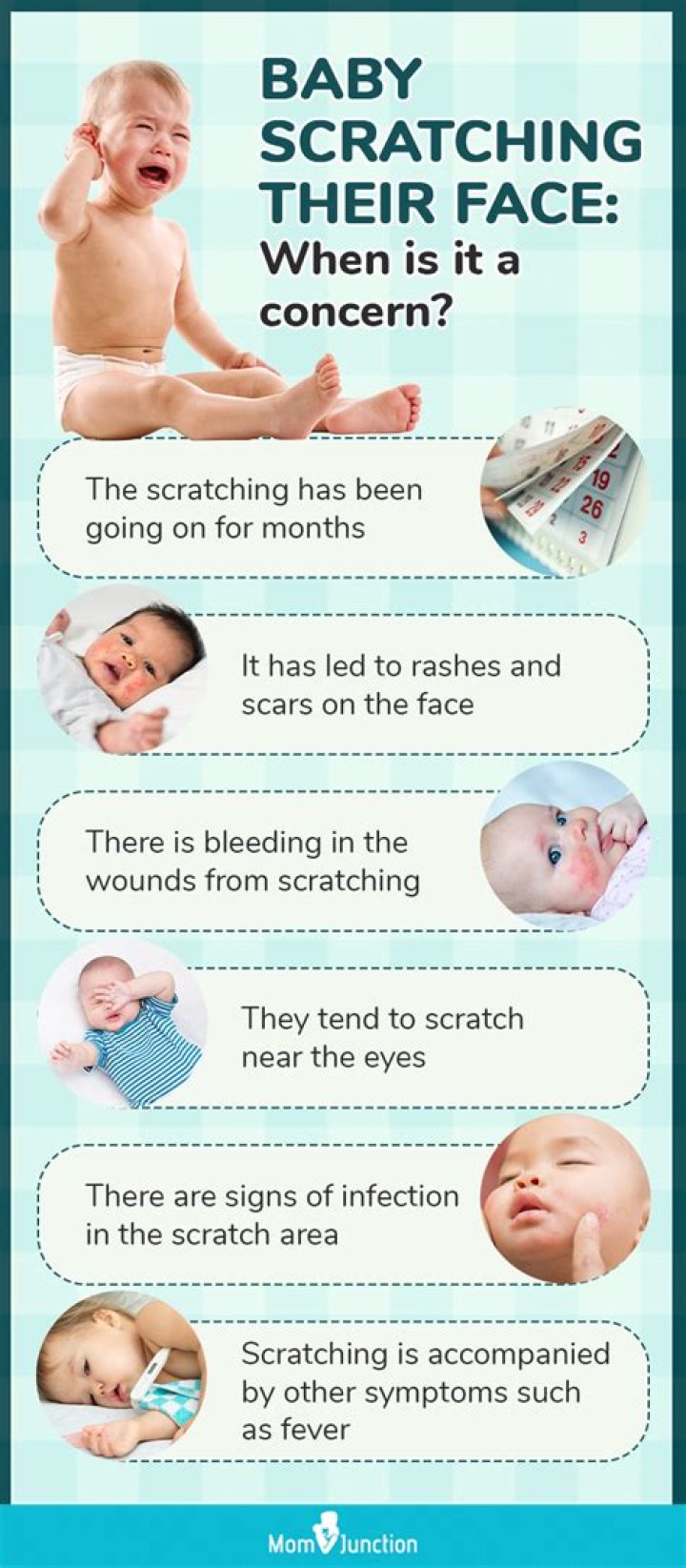How can I stop my baby scratching at night?