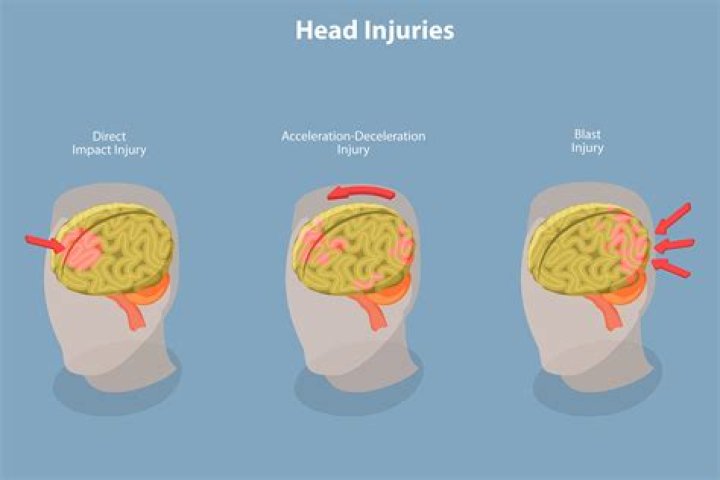 How can I tell if a head injury is mild or severe?