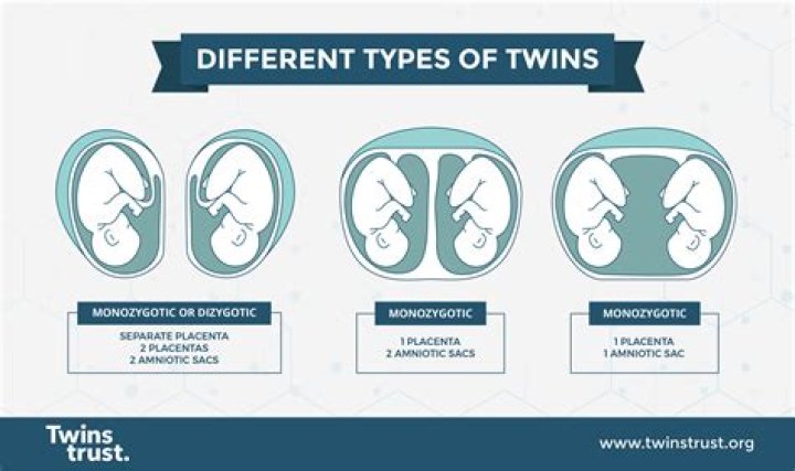 How can you tell if twins are kicking?