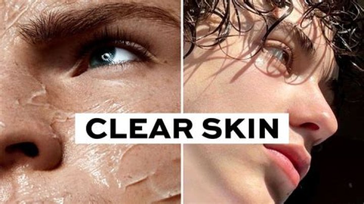 How do celebrities get clear skin?