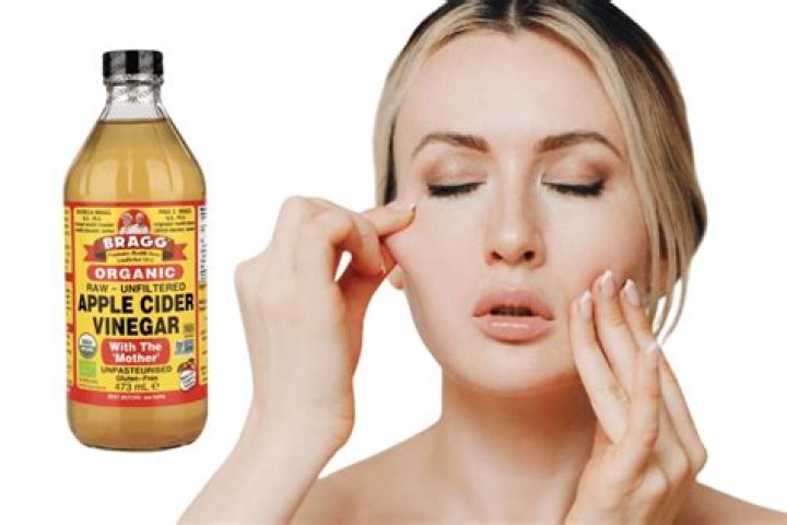 How do I use apple cider vinegar on my face?