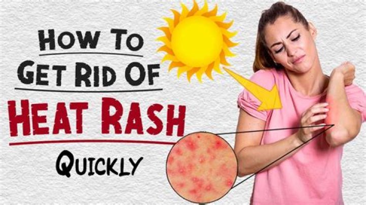 How do you cure a rash naturally?