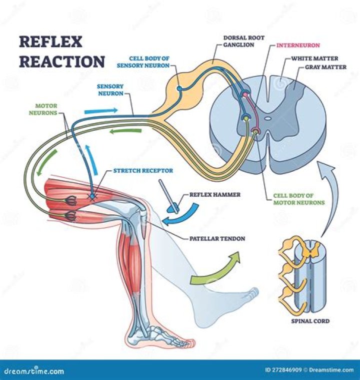 How do you fix hyporeflexia?