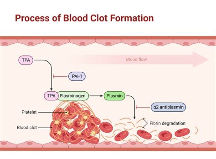 How do you know if a blood clot is moving?