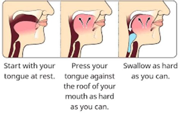 How do you stop pressing your tongue against your teeth?