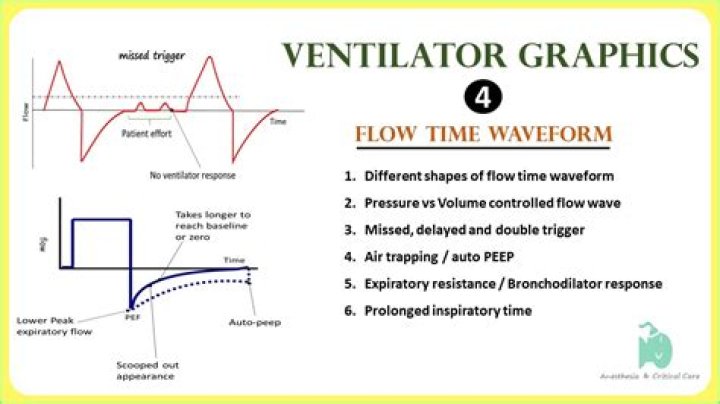 How do you tell if a patient is breathing over the ventilator?