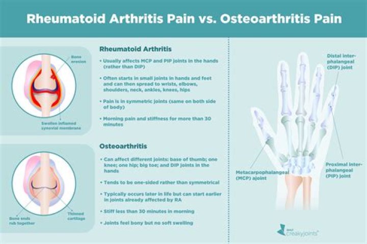 How do you tell the difference between osteoarthritis and rheumatoid arthritis?