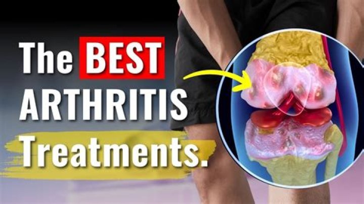 How does a doctor clean out arthritis?