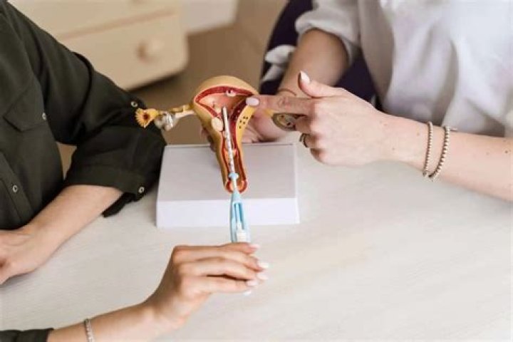 How long after IUD insertion can you take a bath?
