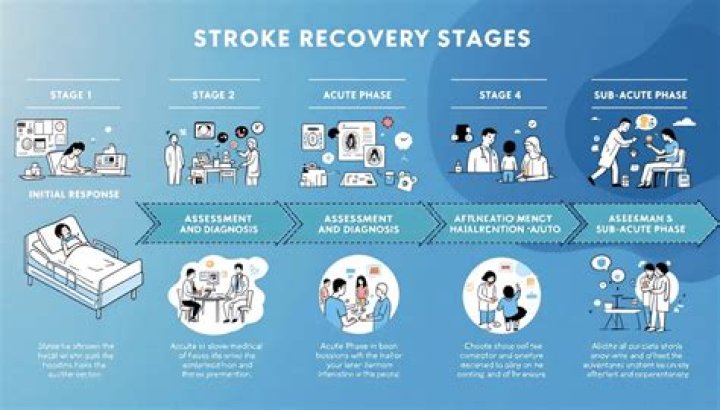 How long are you in hospital for after a stroke?
