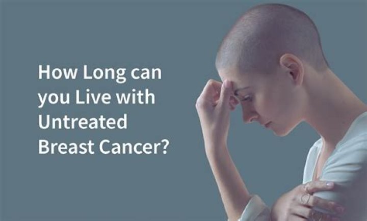 How long can you live with lung cancer without knowing?