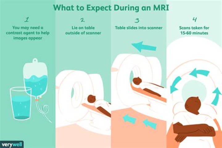 How long does an MRI scan take?