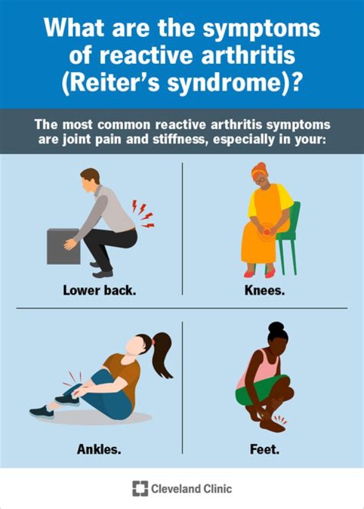 How long does reactive arthritis last?