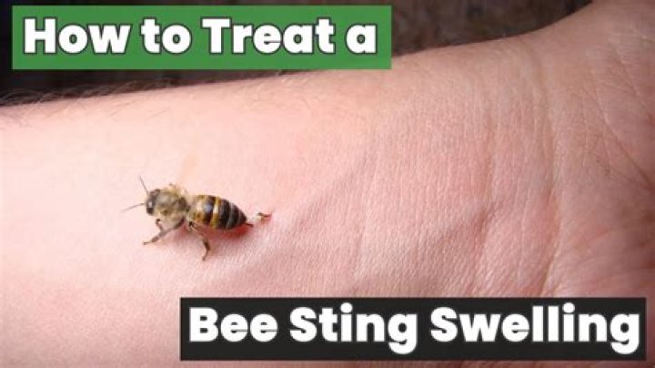 How long will a bee sting stay swollen?