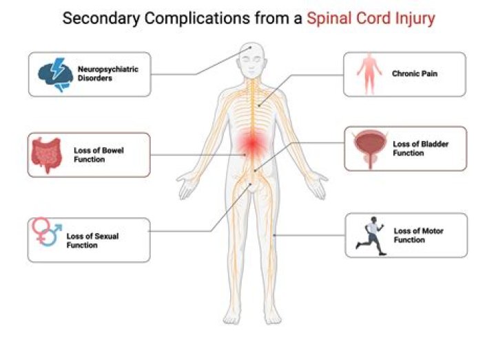 How much does a spinal cord injury cost?