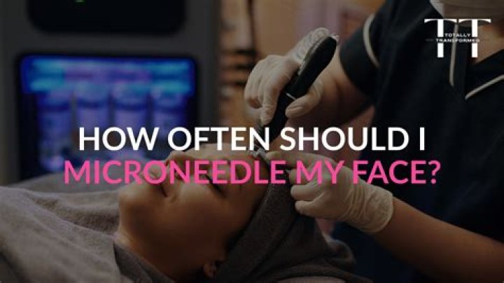 How often should I microneedle my neck?