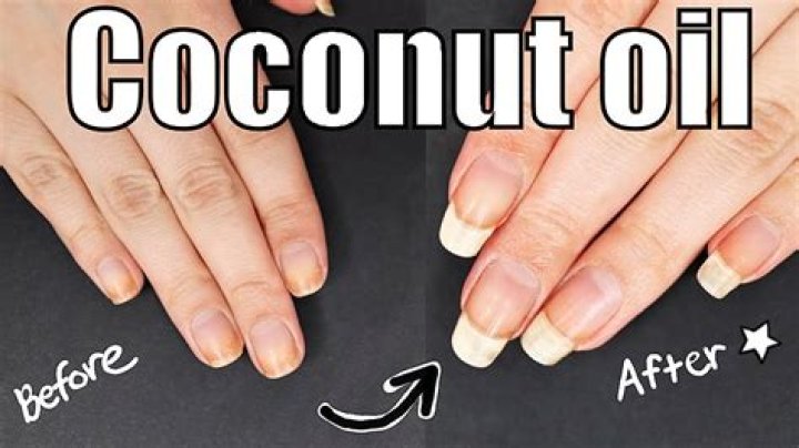 Is coconut oil good for nails?