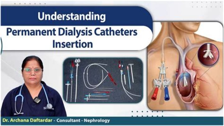 Is dialysis permanent or temporary?