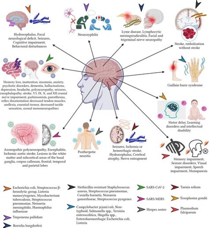Is dizziness a neurological symptom?