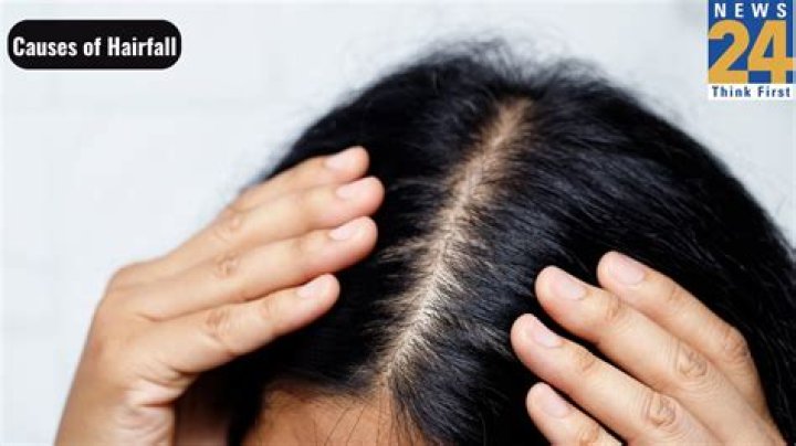Is Hairfall in teenage normal?