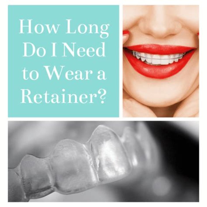 Is it OK to not wear your retainer for one day?