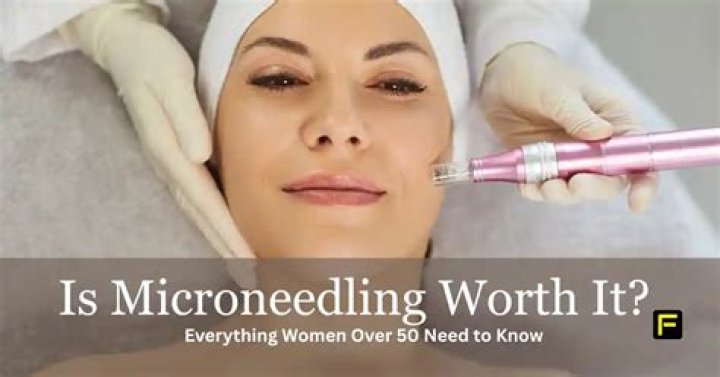 Is micro needling worth it?