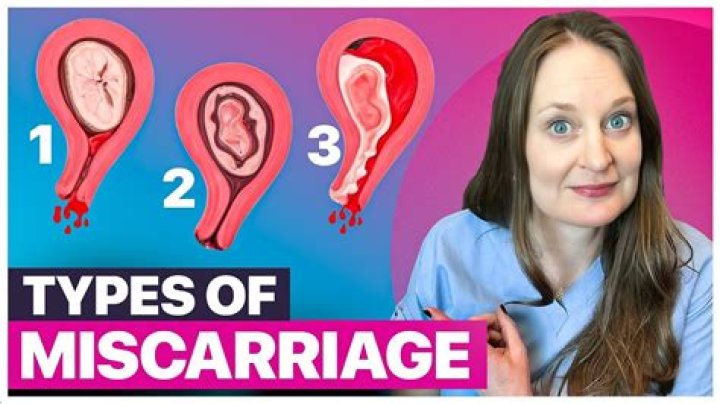 Is miscarriage less likely after heartbeat?