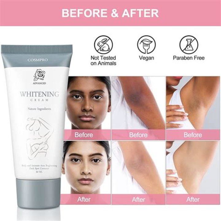 Is Nivea a whitening cream?