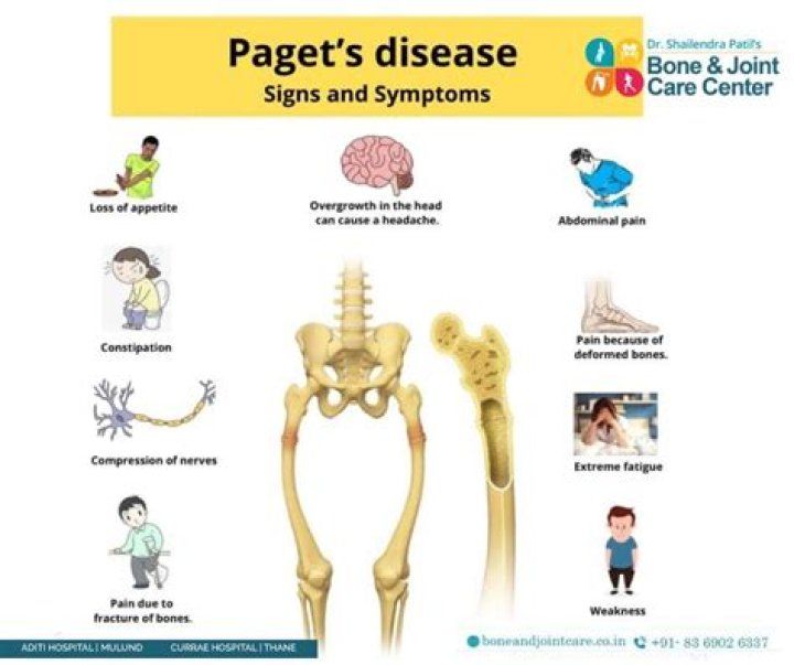 Is Pagets disease painful?