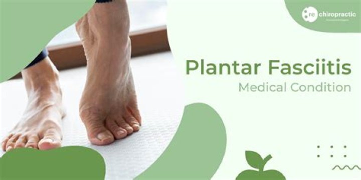 Is plantar fasciitis forever?
