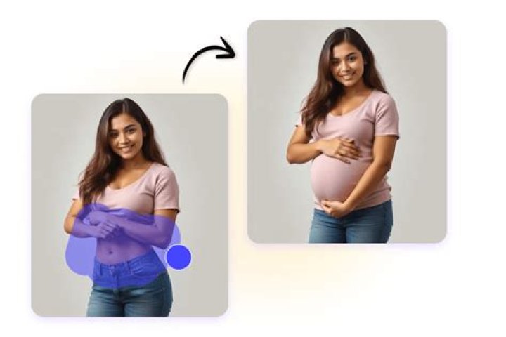 Is there a disease that makes you look pregnant?