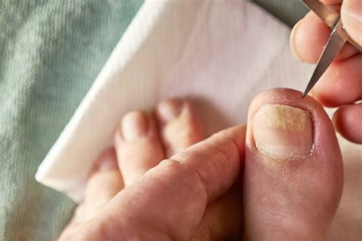 Is there gold in your toenails?