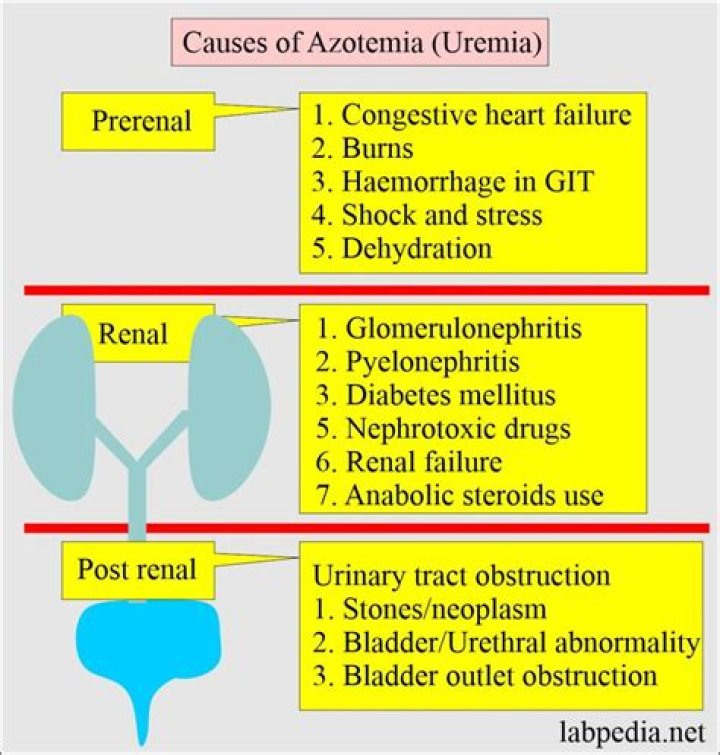 Is urine and urea the same?