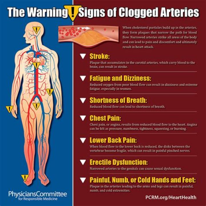 What are the symptoms of a blocked abdominal aorta?