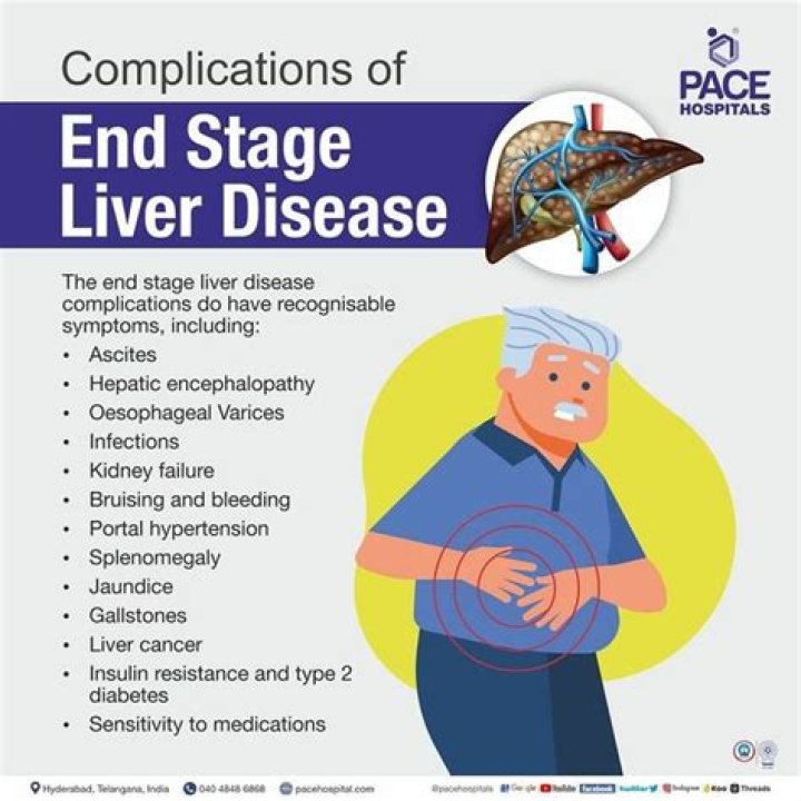 What are the symptoms of end stage liver disease?