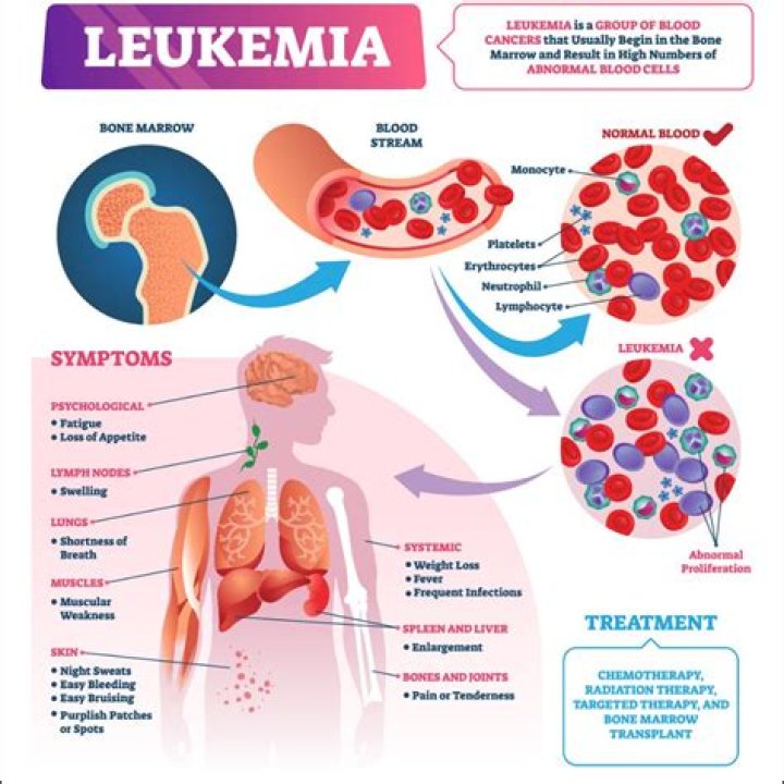 What bones are affected by leukemia?