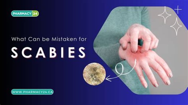 What can be mistaken for mono?
