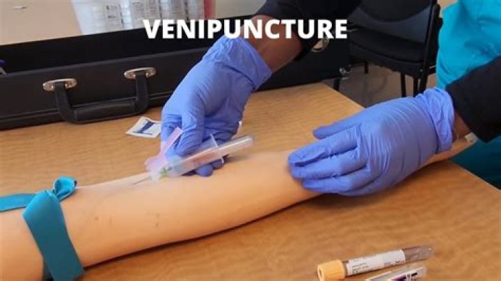 What can go wrong with phlebotomy?