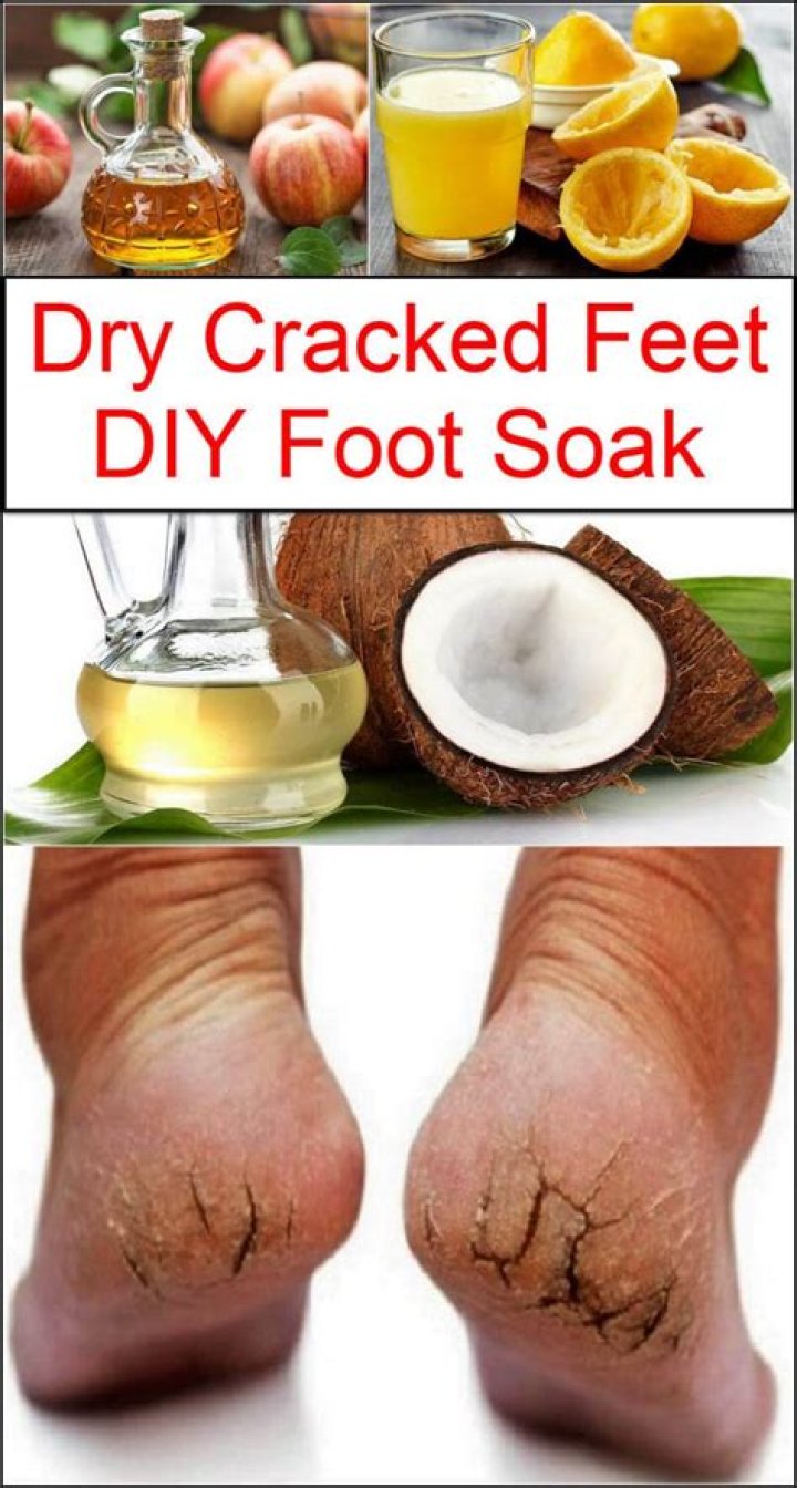 What can I soak my feet in?