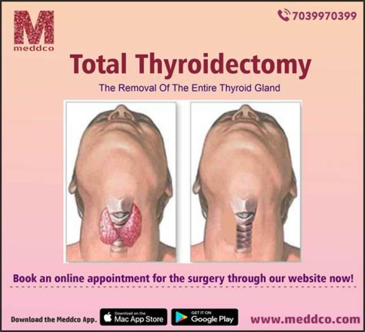 What can you not do after a thyroidectomy?