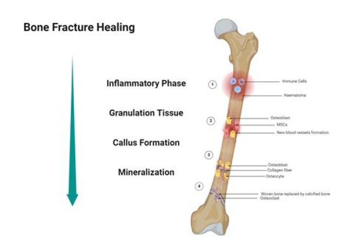 What causes delayed bone healing?
