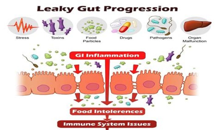 What causes leaky gut?