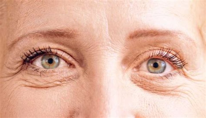 What causes loose skin on eyelids?
