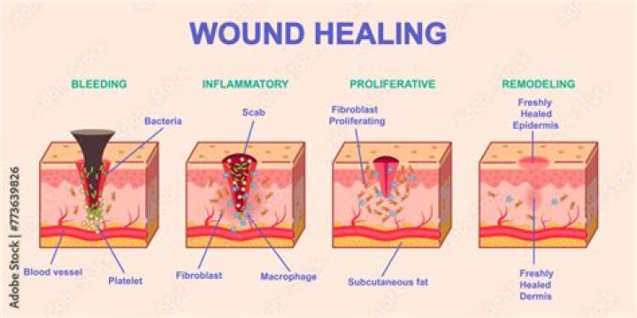 What color is a healing burn?